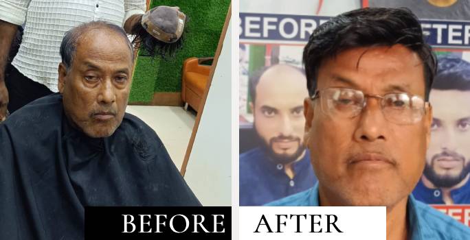 before after 1