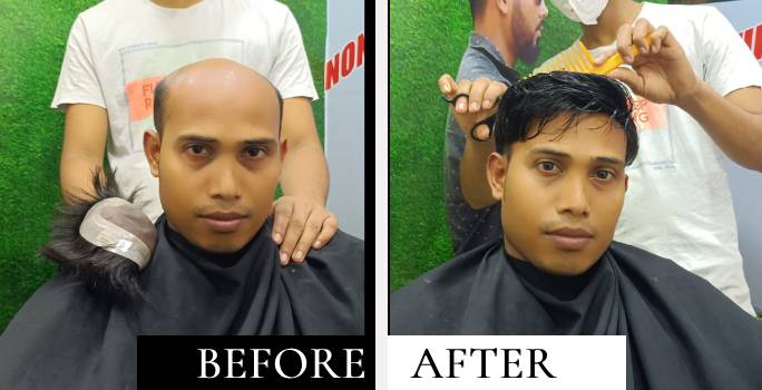 before after 2