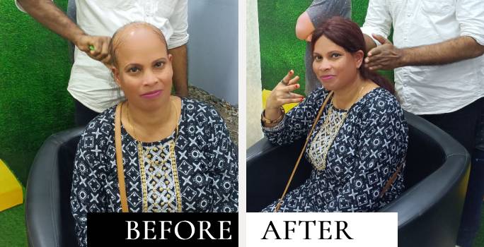 before after 3
