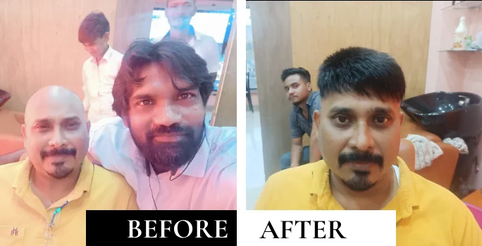 ba-3